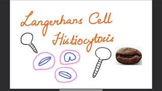 LANGERHANS CELL HISTIOCYTOSIS [upl. by Ettenajna899]