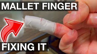 Extensor Tendon Torn Mallet Finger How I heal a Mallet Finger [upl. by Olly]