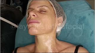 LIFTING FACIAL Enzima Natural [upl. by Rickard220]