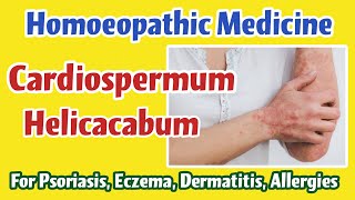 Cardiospermum Helicacabum Homoeopathic Medicine for Psoriasis Eczema Dermatitis Allergies [upl. by Phillips74]