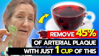 Clear CLOGGED ARTERIES Instantly  Barbara Oneill Reveals The 1 SOLUTION To Change Your Life [upl. by Yrneh605]