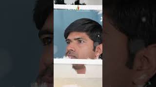 Facial Asymmetry Correction  Best Results  Face Surgeon in Kerala  Dr Mathew PC shorts [upl. by Arnelle]