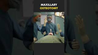 Maxillary Osteotomy Procedure 3D Animation [upl. by Ethban136]