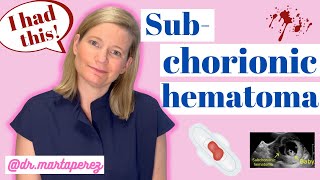 OBGYN Explains Subchorionic Hematoma  My Story First Trimester Bleeding [upl. by Fisoi]