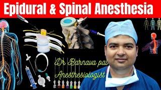 Epidural Anesthesia amp Spinal Anesthesia [upl. by Shum73]