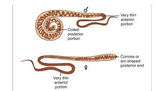 Trichuris trichiura [upl. by Husch244]