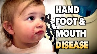 Foot and Mouth Disease Vaccination Overview [upl. by Hiroshi]