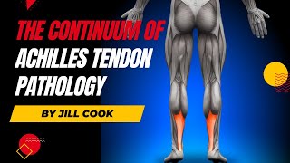 The Continuum of Achilles Tendon Pathology by Jill Cook [upl. by Coyle537]