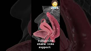 endometriosis shortsfeed youtubeshorts shorts [upl. by Hawkie]