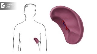 What causes a spleen to enlarge Can you a shrink an enlarged spleen  Dr Lorance Peter [upl. by Sel]