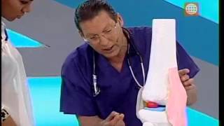 Dr TV Perú 04112013  B3  Asistente del día Dolor de rodilla [upl. by Sayles]