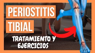 🦵PERIOSTITIS TIBIAL 💥 Qué es Causas Ejercicios y Tratamiento [upl. by Tolmach]