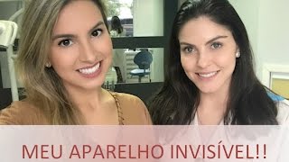 Como funciona o aparelho invisível [upl. by Lavena]