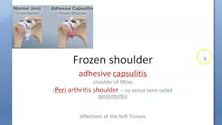 Orthopedics 323 Frozen Shoulder Arthritis adhesive capsulitis shoulder [upl. by Parent515]