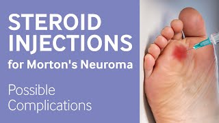 Mortons neuroma steroid injection complications [upl. by Eidua]