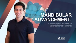 4 Tips for your mandibular advancement treatments  SAS [upl. by Arat]