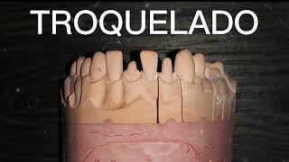 TROQUELADO DENTAL ✅ 🦷🦷🦷🦷 [upl. by Ahsatak]