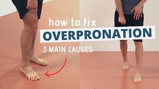 Pronated Feet and How to Fix 3 Different Causes of OVERPRONATION [upl. by Ayama]