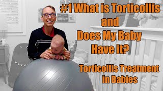 1 What is Torticollis and Does My Baby Have it Torticollis Treatment in Babies [upl. by Edijabab]