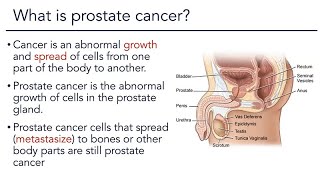 Prostate Cancer Overview [upl. by Derfniw431]