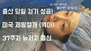 미국 제왕절개 역아 4일간의 입원생활 기록 출산 당일 걸었어요 [upl. by Egedan615]