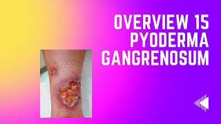 Overview 15  Pyoderma Gangrenosum [upl. by Studley]