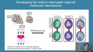 Selective Neuronal Vulnerability in Neurodegeneration [upl. by Einnad]