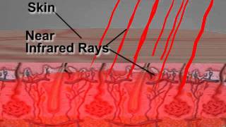 How Far Infrared Technology Works [upl. by Ecirted]