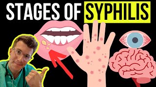 Doctor explains the Symptoms and Stages of SYPHILIS STI [upl. by Eeuqram]