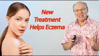 New Treatment Helps Eczema [upl. by Aenahs]