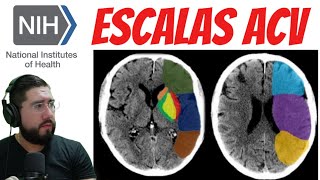 📎 Escala de NIHSS y ASPECTS para abordaje de ACCIDENTE CEREBROVASCULAR ✍🏻🧠 [upl. by Ynej218]