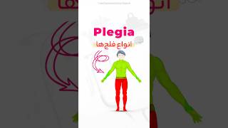 Let me explain different types of plegia 👨‍🦽 shorts medical neurology [upl. by Aihtnis]