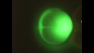 Injection of fluorescent dextran beads in the mouse zygote [upl. by Yancey951]