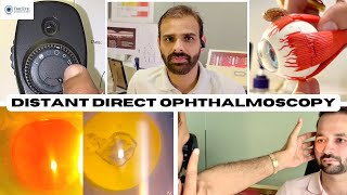 Distant Direct Ophthalmoscopy [upl. by Ericka]