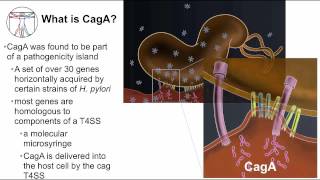 Gastritis H pylori cancer pathogenesis [upl. by Danita]