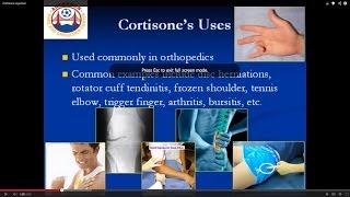 Your guide to cortisone injections [upl. by Ranite278]