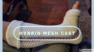 Short Leg Hybrid Mesh Cast application [upl. by Ainorev349]