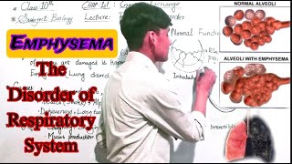 Emphysema  The disorder of Respiratory System Class 10th Biology [upl. by Aonehc]