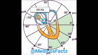 EKG basics  What is sinus rhythm doctor [upl. by Lelah]