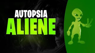 Autopsia aliene  Dokumentar Shqip [upl. by Emilie639]