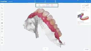 E5 Fussen IntraOral Scanner S6000 Options After Scanning [upl. by Corabelle]