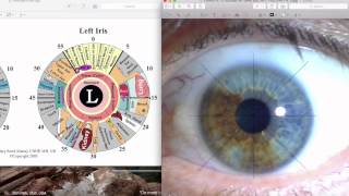 Iridology Reading 1 [upl. by Nekial]