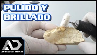 Corona Provisional De Acrilico  Técnica Llave De Silicona Matriz Parte 2 [upl. by Ayifas58]