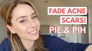 How To Fade Acne Scars Post Inflammatory Erythema amp Post Inflammatory Hyperpigmentation [upl. by Corbet]