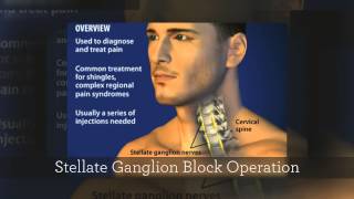 Dr Kornick Riverside Spine Jacksonville Florida 904 3891010 Stellate Ganglion Block [upl. by Lynnelle]