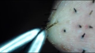 Plucking Facial Hair Extremely Closeup  Up Close Humans [upl. by Ponton]