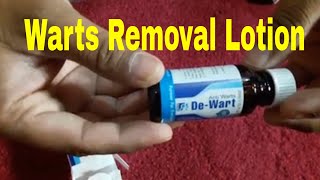 Wart Removal Lotion [upl. by Atinuaj881]