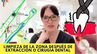 ¿Cómo limpiar la zona de mi extracción ó cirugía dental [upl. by Assiluy]