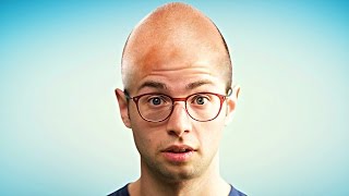 Everything You Need To Know About Mens Hair Loss [upl. by Moyers842]