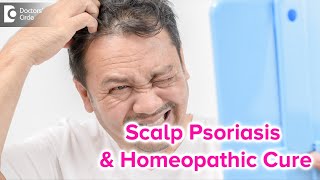 SCALP PSORIASIS  Causes Symptoms amp BEST HOMEOPATHIC REMEDY  Dr Rashmi K  Doctors Circle [upl. by Aihseym]